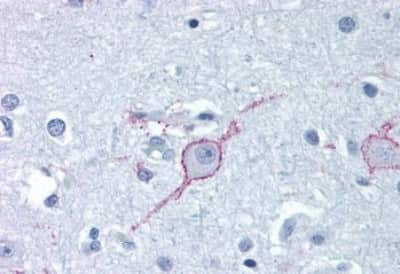 Immunohistochemistry-Paraffin: Galanin R3/GALR3 Antibody [NBP3-14330] - Immunohistochemistry of formalin-fixed, paraffin-embedded human brain, cortex, after heat-induced antigen retrieval.